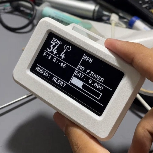 Handheld printed case showing an alert reading with a finger sensor and battery level